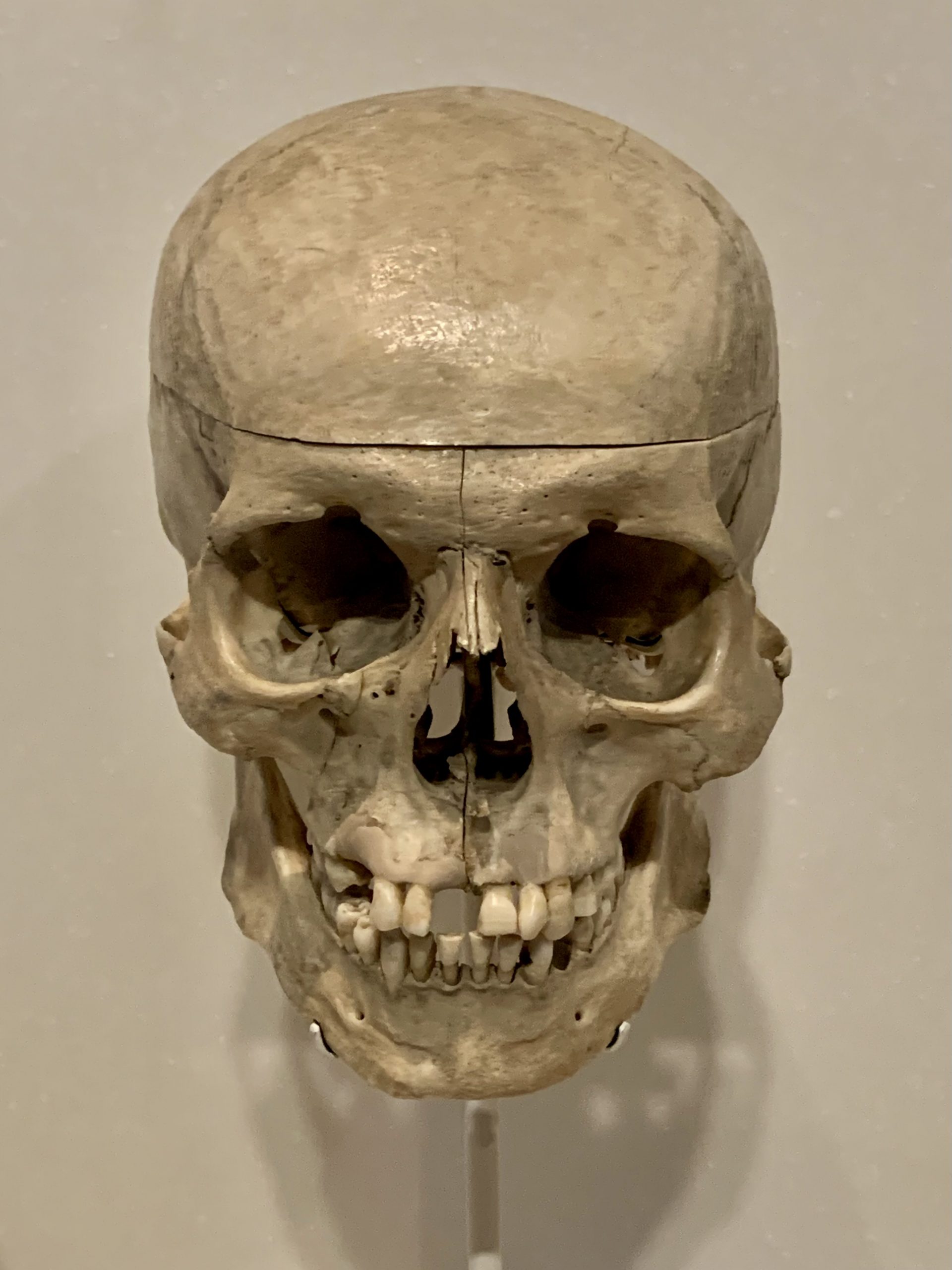 Human skull