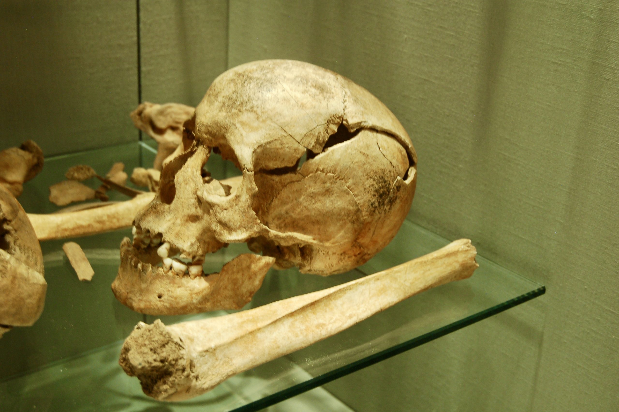Arbeia Skull
