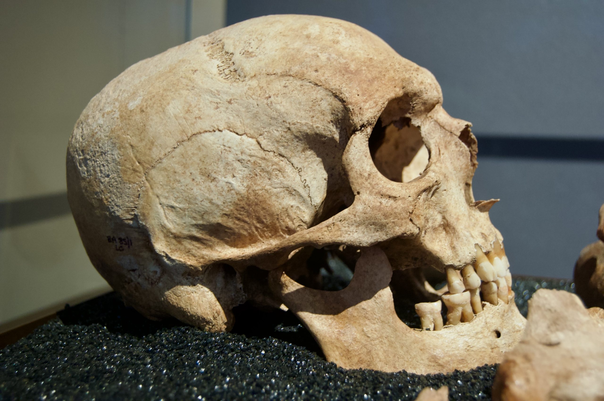 Skull